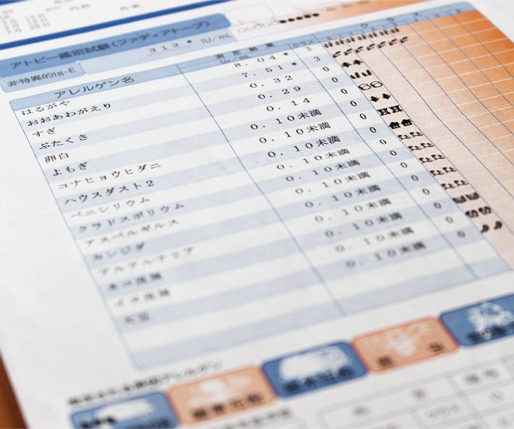検査